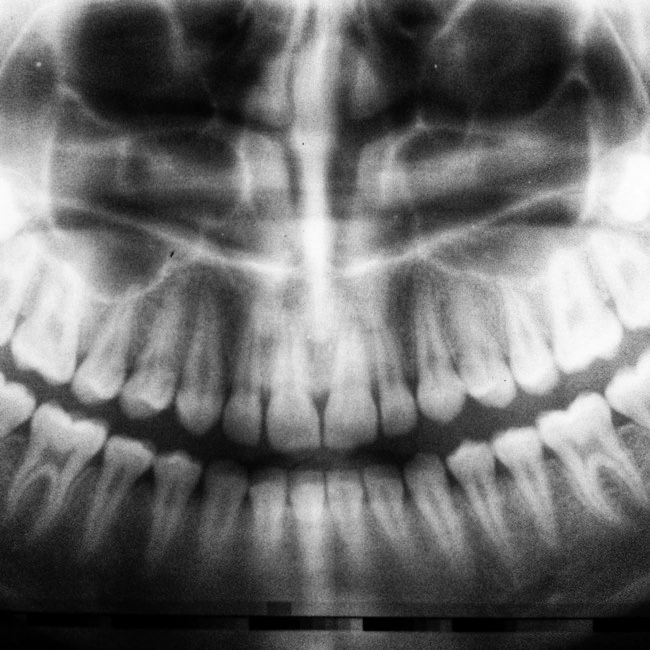 dental xray