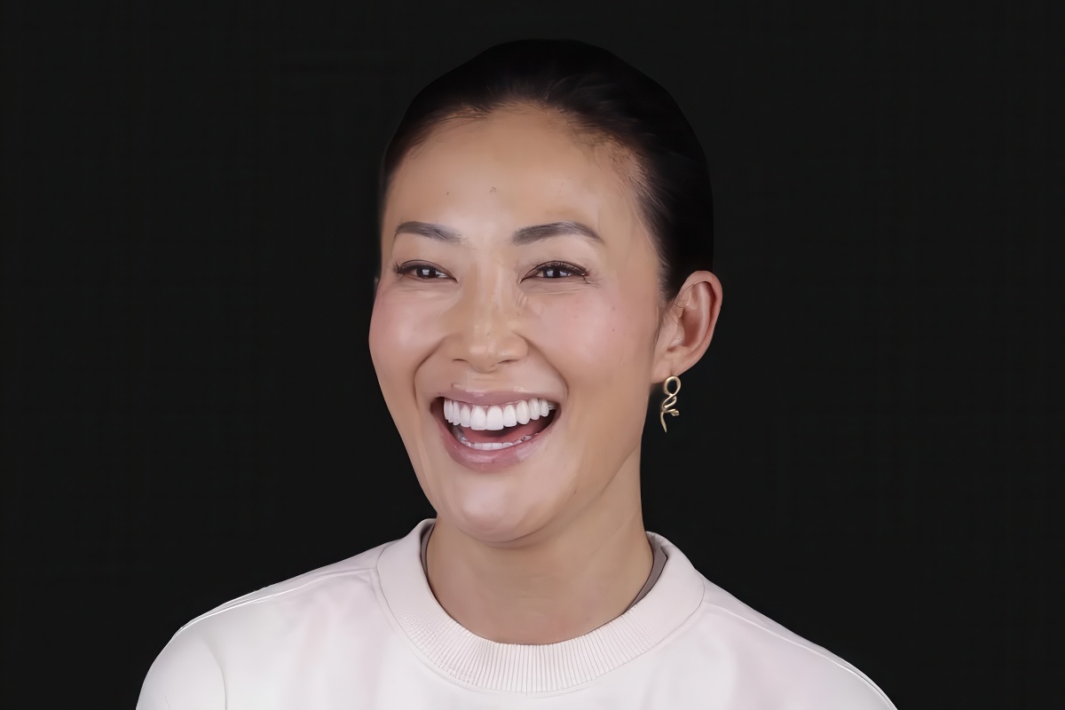 our real LA veneers patient