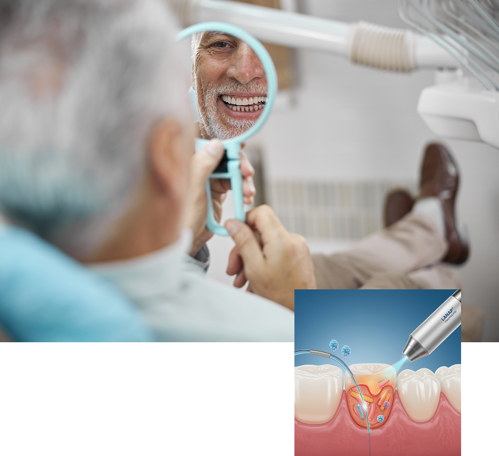 Smiling man at the dentist looking in a hand mirror and LANAP procedure