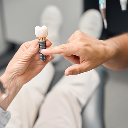 dental implant model