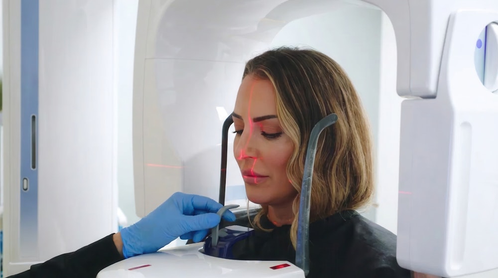 Woman receiving CBCT scan with red laser guides on her face during dental imaging procedure