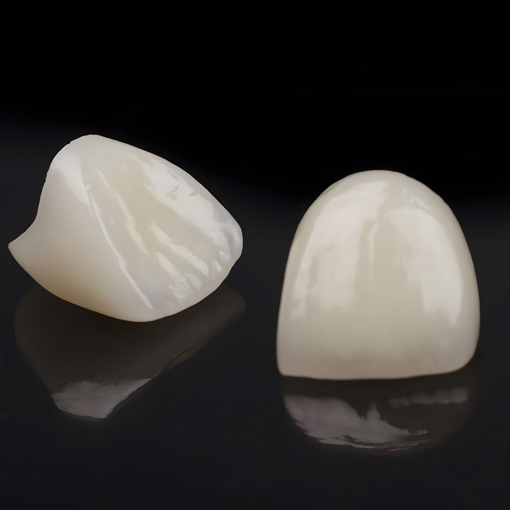 dental crowns
