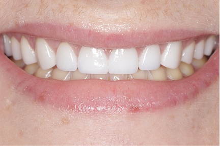 Smile of a client after treatment