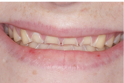 Smile of a client before treatment