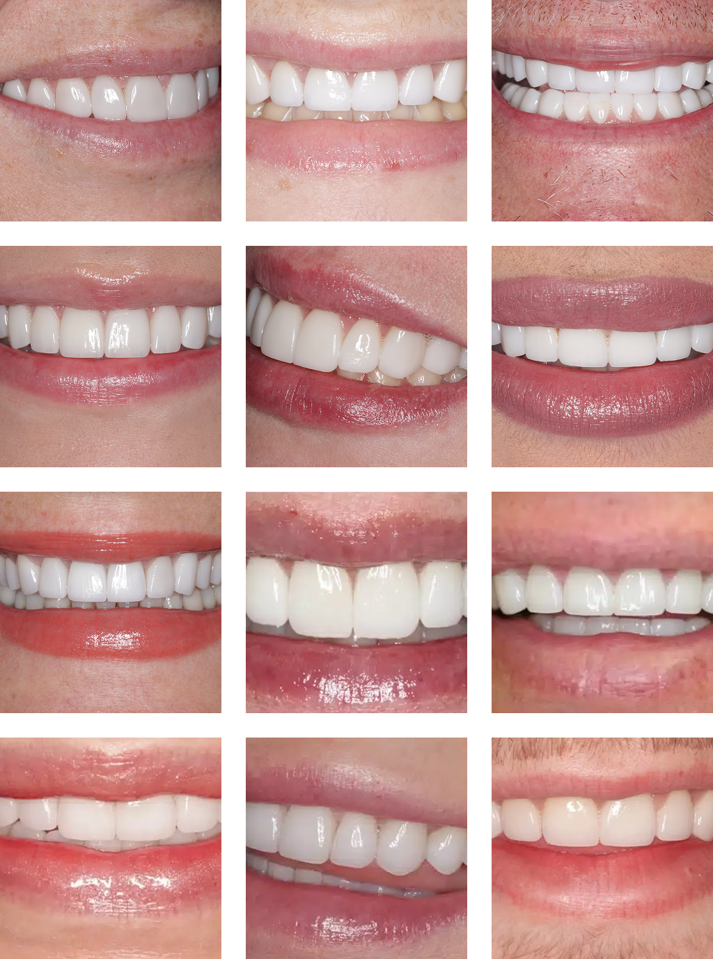 collage of real patient smiles
