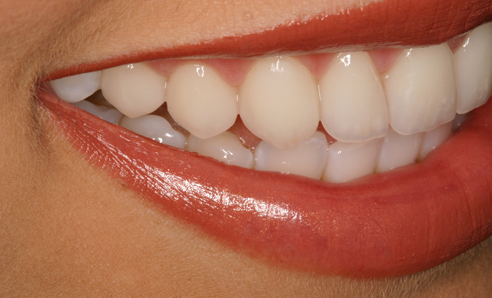 Close up of beautiful smile