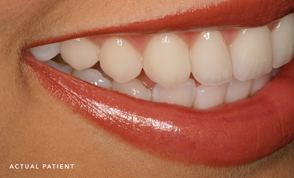 Close up of beautiful smile