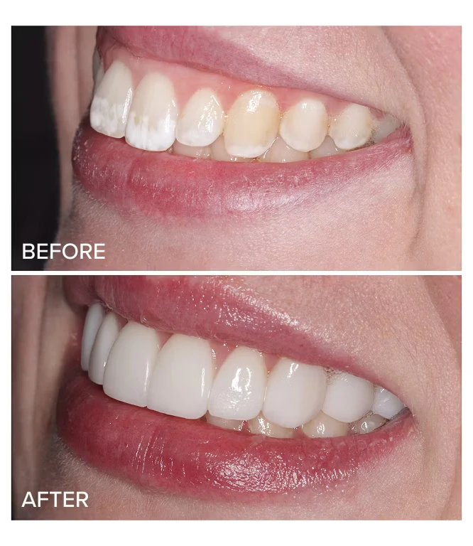 Results before and after cosmetic procedure