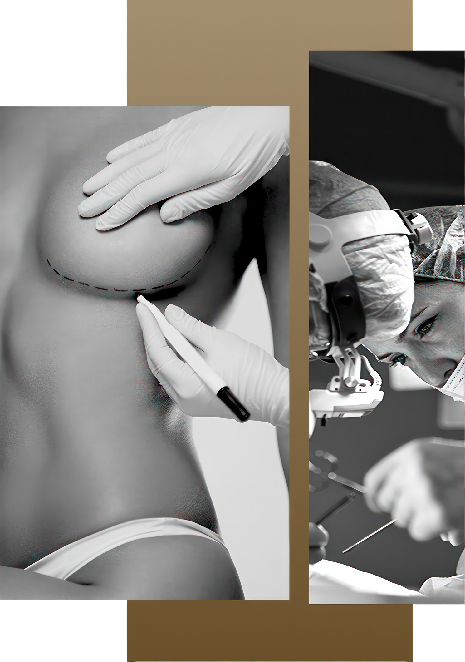 Breast surgery collage