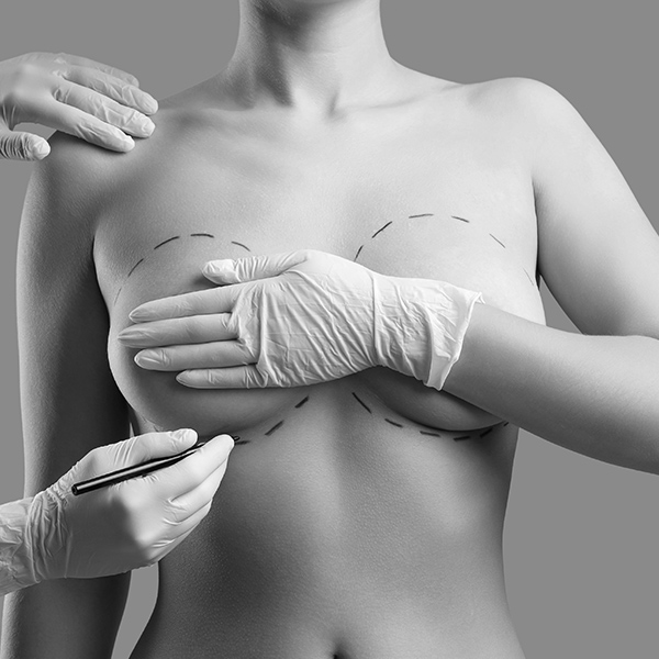 Woman being prepped for breast surgery