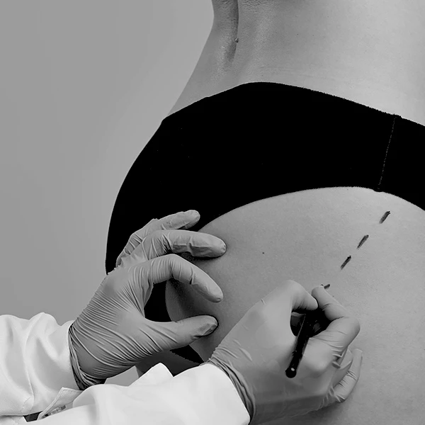 woman preparing for surgery