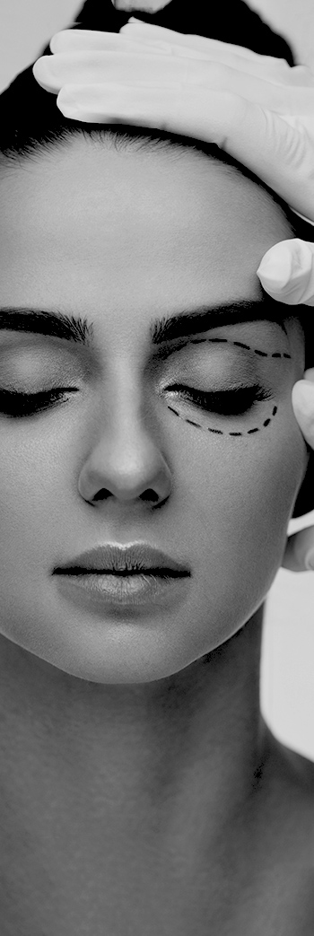 Close-up of a woman with eyes closed while a clinician wearing gloves marks dotted surgical guidelines beneath her lower eyelids during a blepharoplasty consultation.