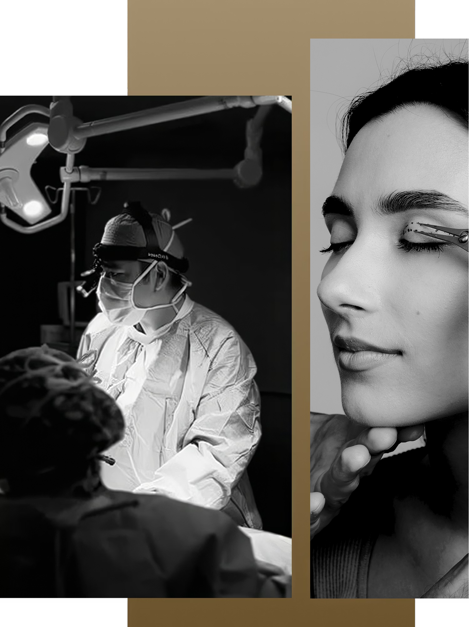 Split image showing Dr. Charleston Chua performing surgery in an operating room beside a close-up of a woman with surgical markings on her upper eyelid during a blepharoplasty consultation.