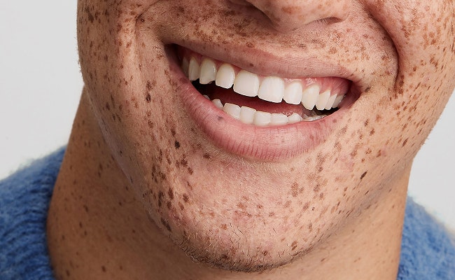 Freckled man smiling
