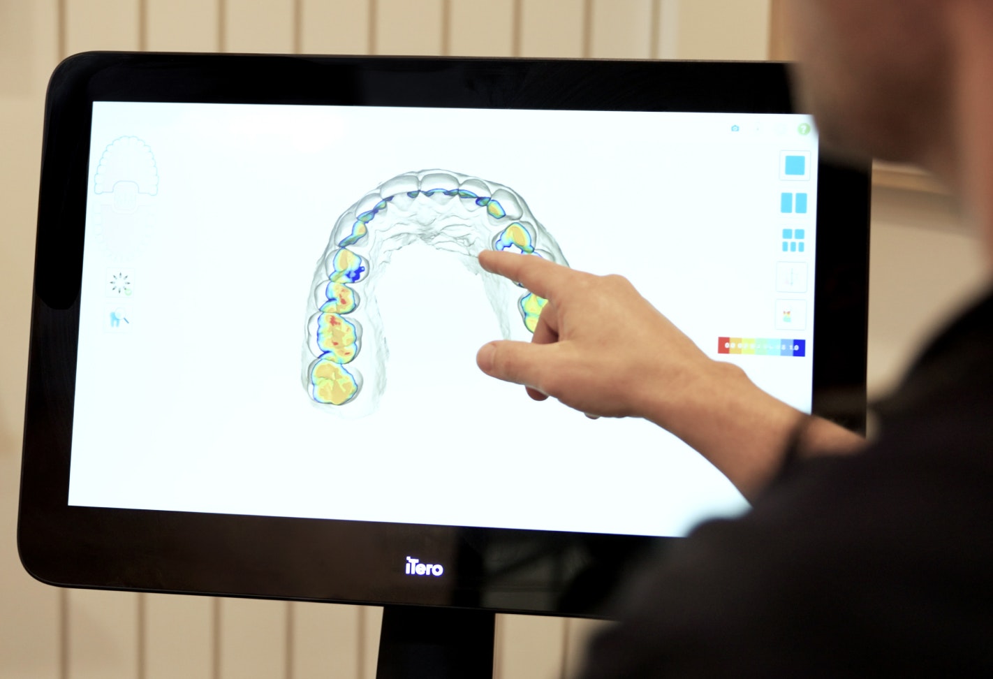 Clear aligner software