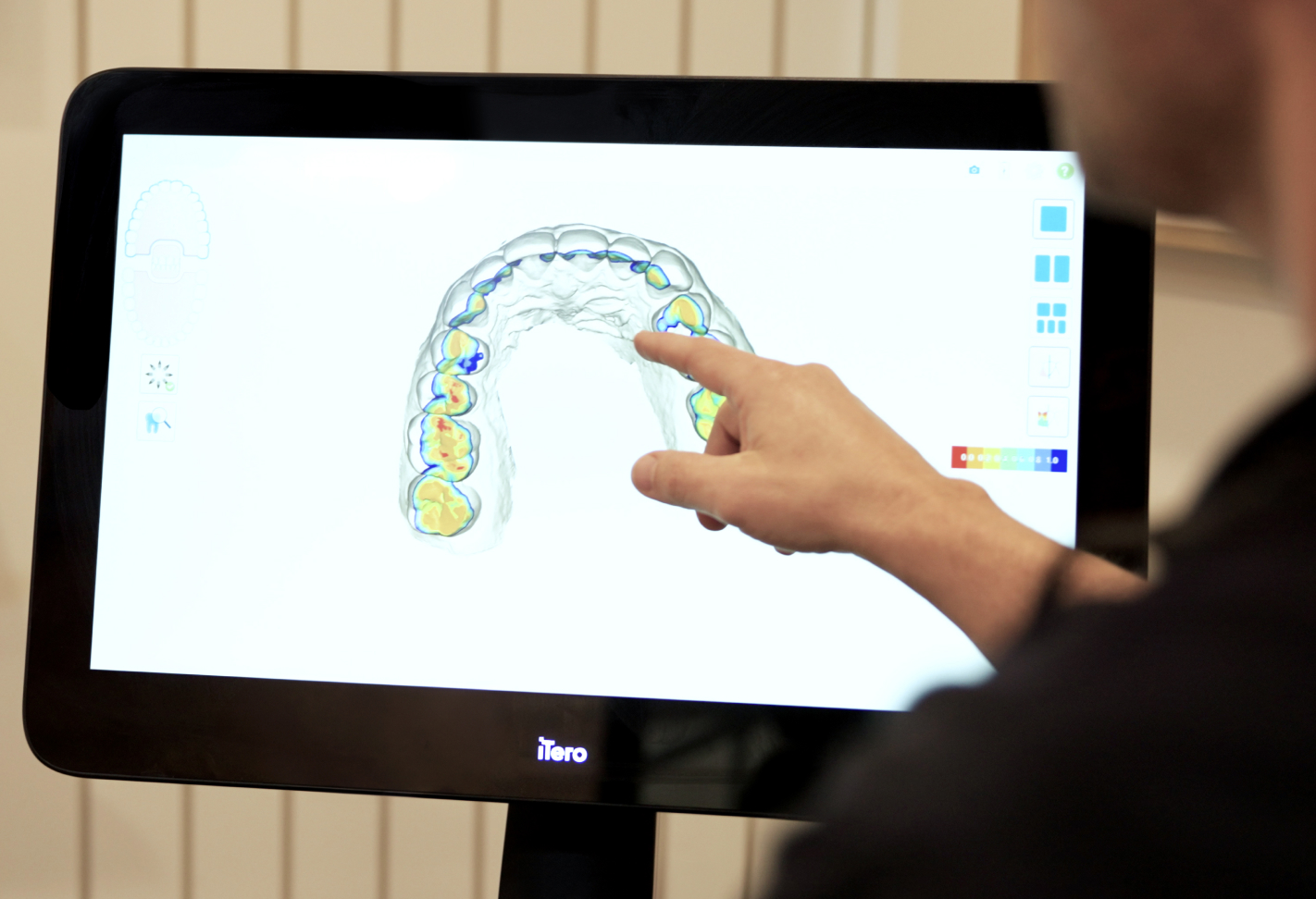 Clear aligner software