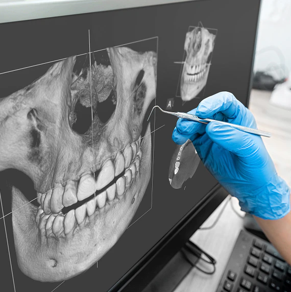 Scan of teeth