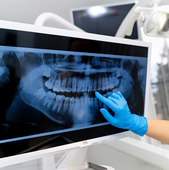 X-ray on a screen