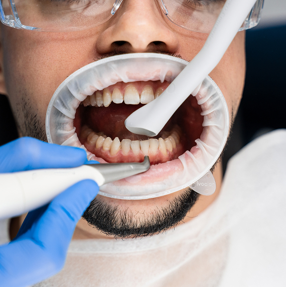 man getting his teeth cleaned