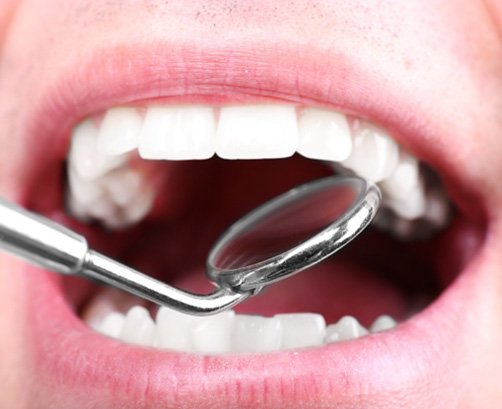 Person getting teeth examed