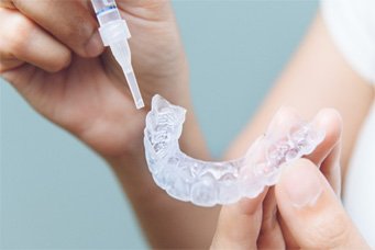 take home teeth whitening kit