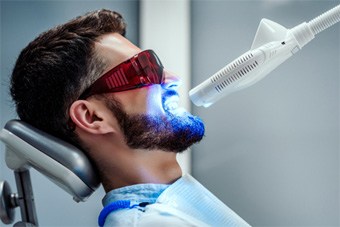 in office teeth whitening