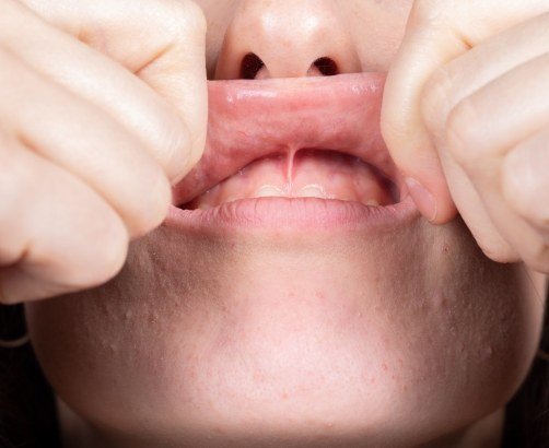 close up photo of a person