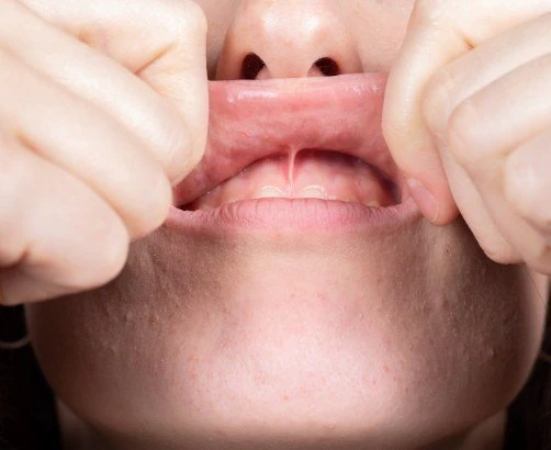 close up photo of a person