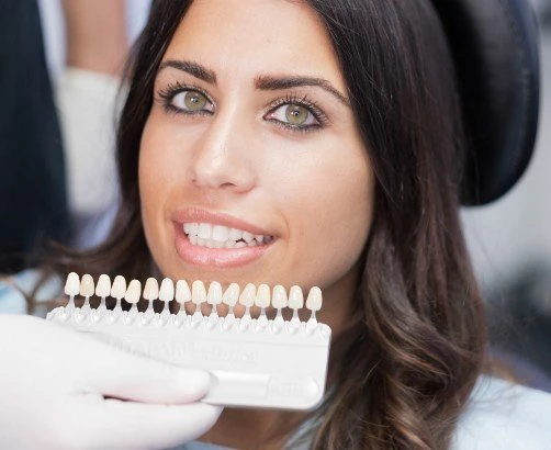 Woman getting veneers matched