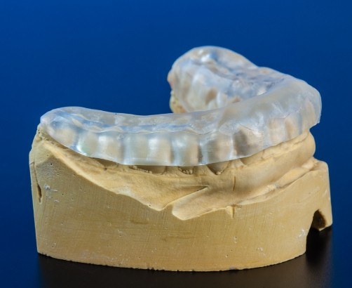 Occlusal Splint