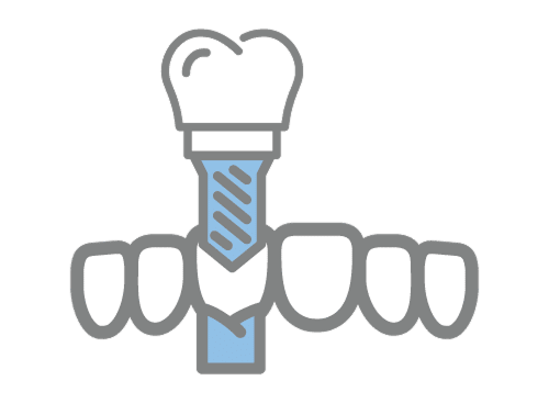 Dental Implants