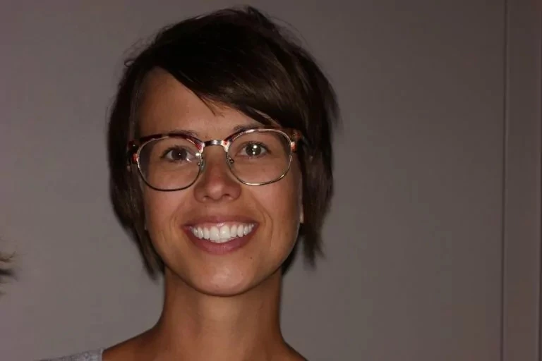 Patient before Invisalign