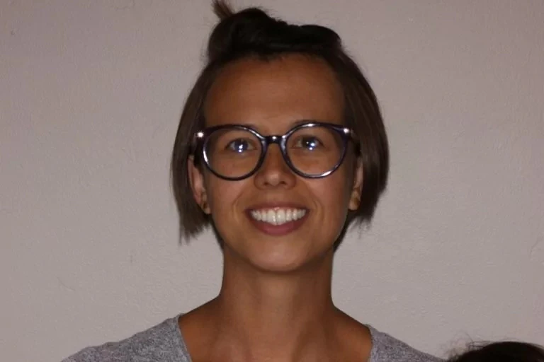 Patient after Invisalign