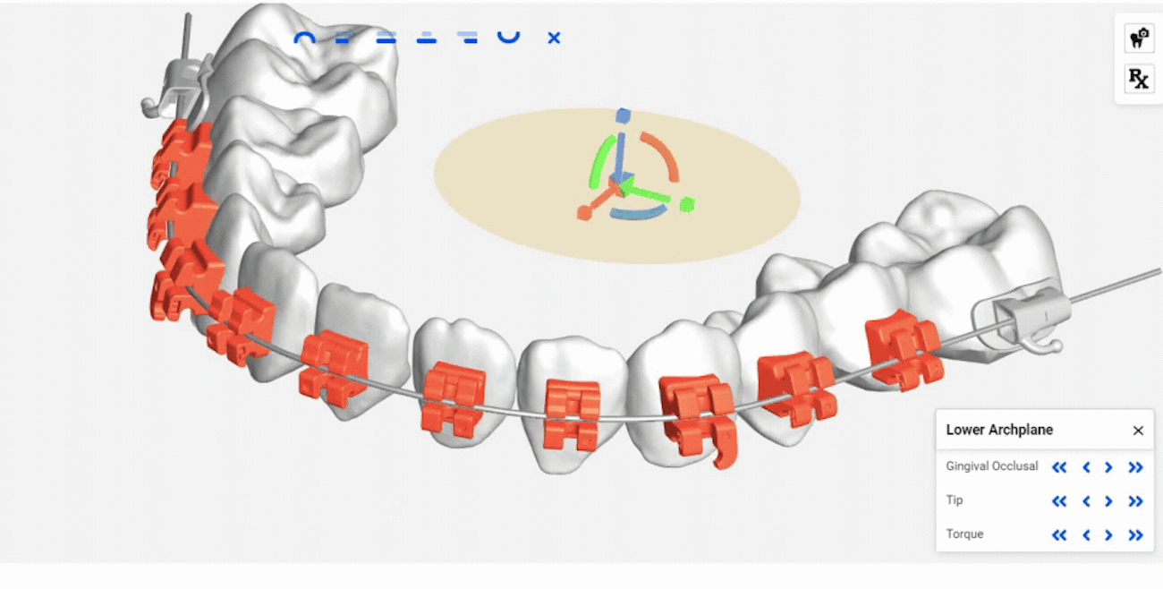 image of a digital rendering of braces