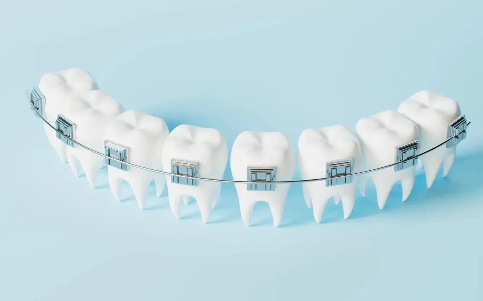 teeth with braces in an arch