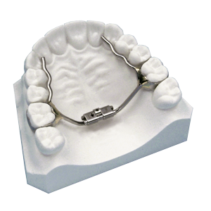 Palatal Expanders