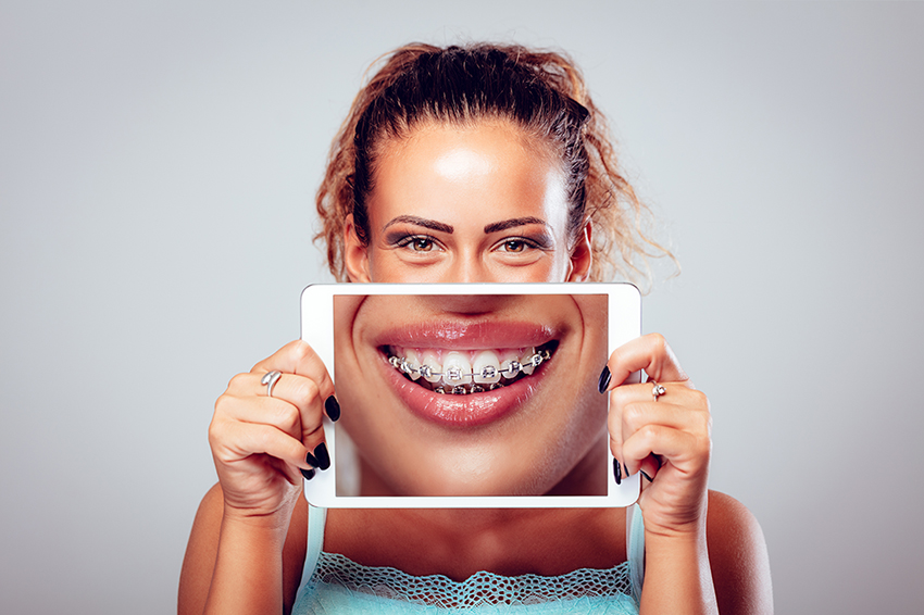 woman holding up picture of braces