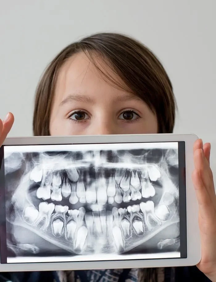 Child holding dental x-rays