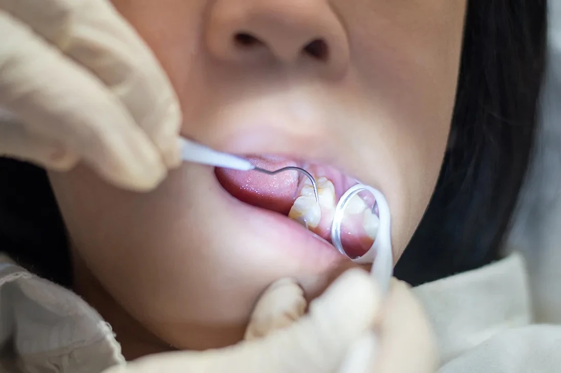 Pediatric dental exam
