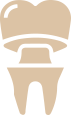 Veneers