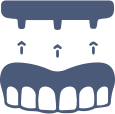 full arch implant icon