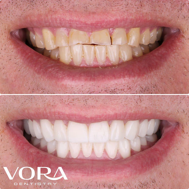 Real patient before and after case 3