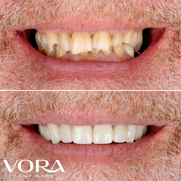 Real patient before and after case 2
