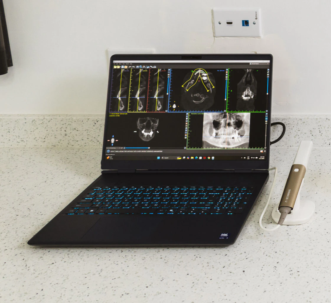 Photo of computer with dental xrays