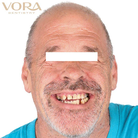Real Patient Before