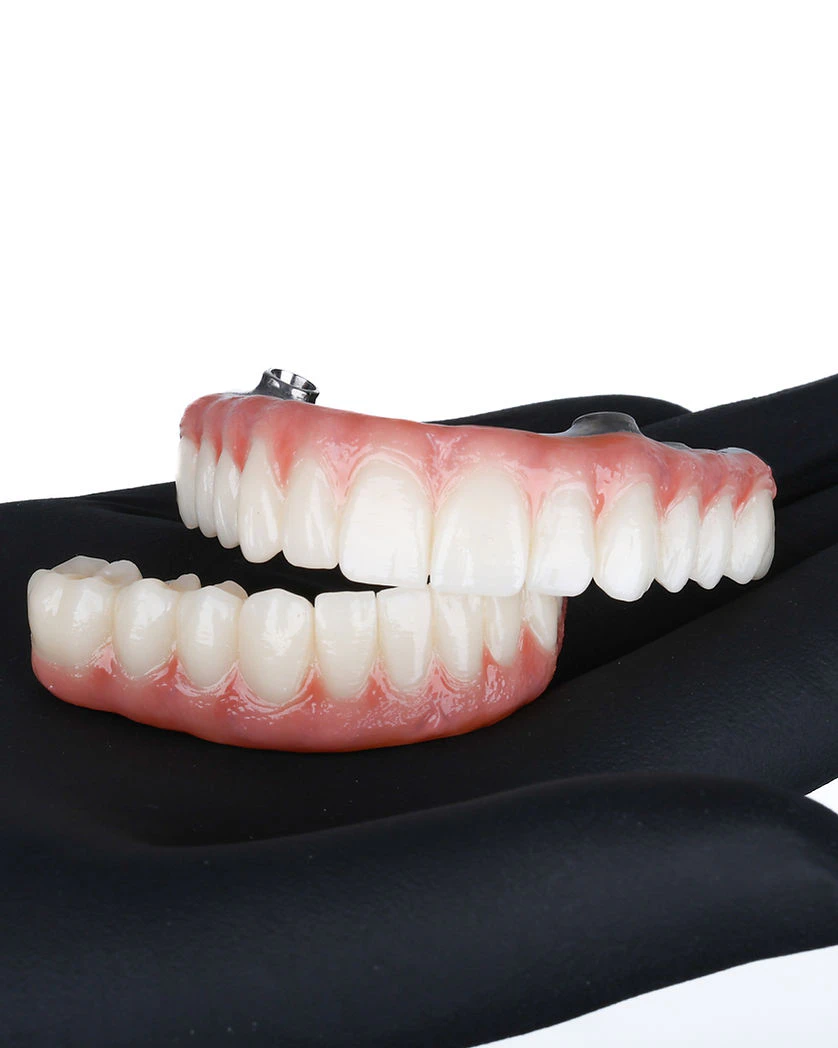 All-on-4 implants from VORA Dentistry in a gloved hand