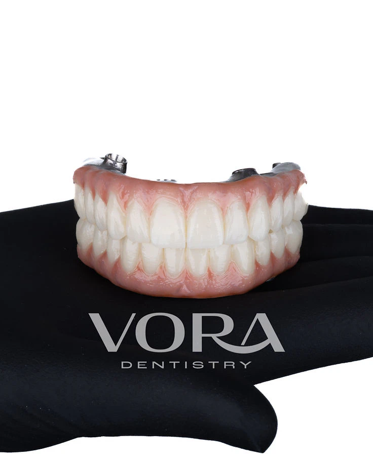 Dentures from VORA Dentistry on black glove