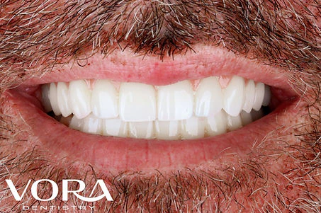Close up photo of Real Patient After