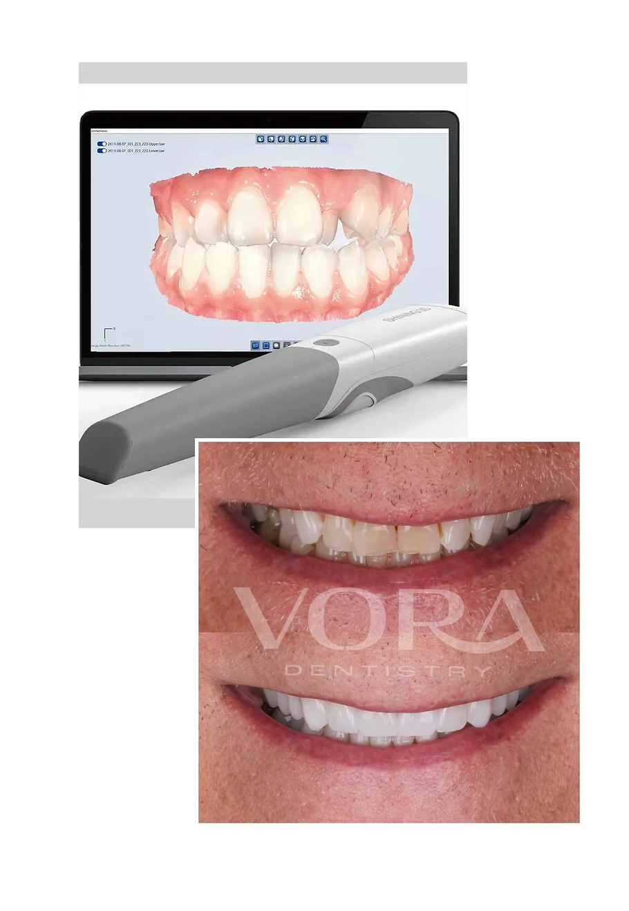 Screen Capture over a VORA Dentistry Before and After