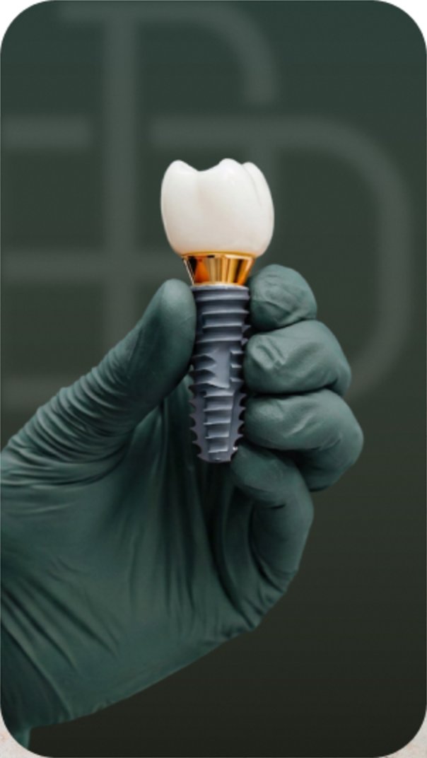 Dental implant with crown held in a gloved hand